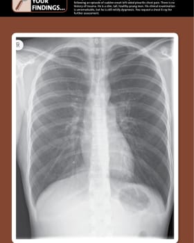Unofficial Guide to Chest X-rays cover