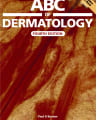 ABC of Dermatology cover