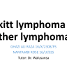 Burkitt Lymphoma Overview and Management cover