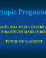Ectopic Pregnancy cover