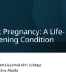 Ectopic Pregnancy cover