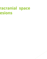 space occupying lessons cover