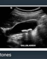 RADIOLOGY PICS FOR SURGERY OSCE cover
