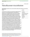 VARICELLA ZOSTER VIRUS INFECTION cover