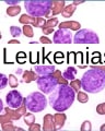 LEUKAEMIAS and Hodgkins cover