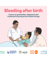 BLEEDING AFTER BIRTH: COURSE ON PREVENTION, DIAGNOSIS AND TREATMENT OF POSTPARTUM HAEMORRHAGE cover