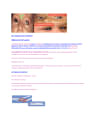 OSCE Ophthalmology cover