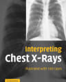 Interpreting Chest X-Rays: Illustrated with 100 Cases cover