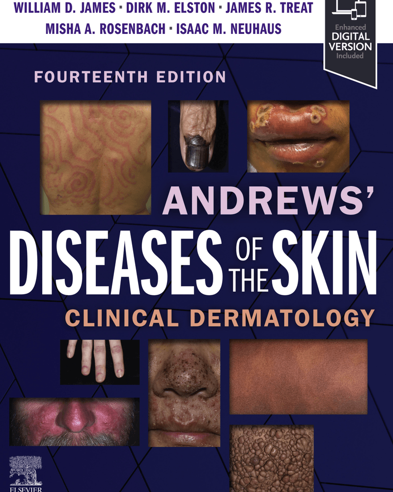 Andrews' Diseases of the Skin Clinical Dermatology 14th Edition cover