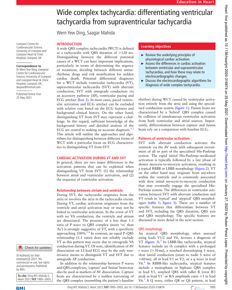 WIDE COMPLEX TACHYCARDIA: DIFFERENTIATING VENTRICULAR TACHYCARDIA FROM SUPRAVENTRICULAR TACHYCARDIA cover