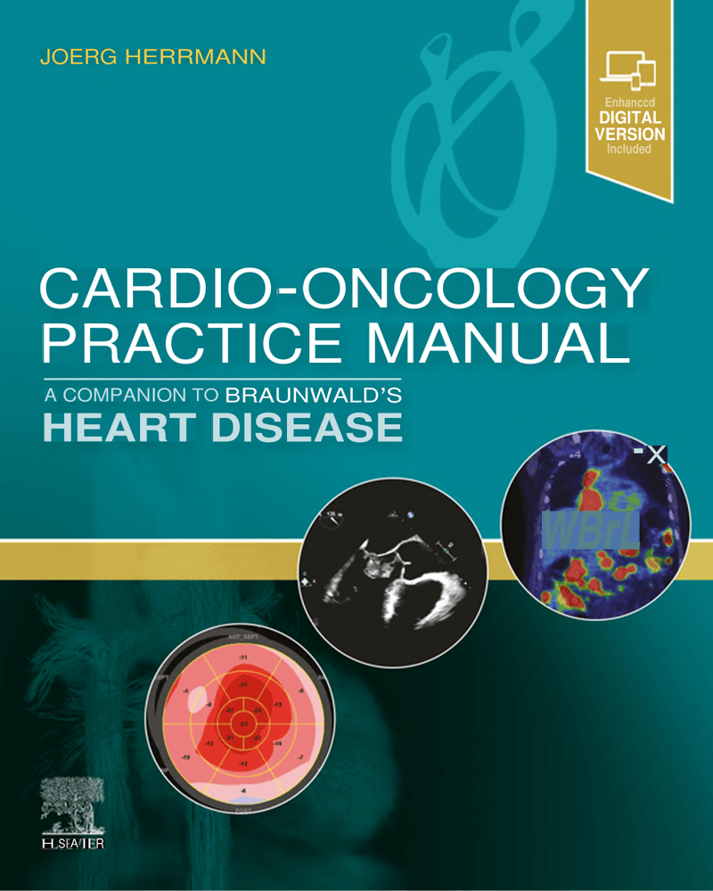 Cardio Oncology Practice Manual A Companion to Braunwalds Heart cover