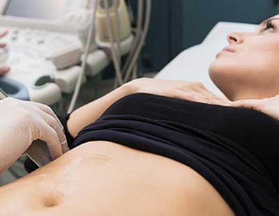 Ectopic Pregnancy