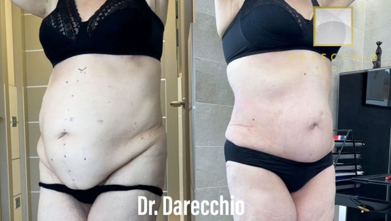 Diastasis Recti 101 – Dr. Jackie Kickish