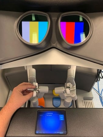 La console robotique utilisée par le Dr. Darecchio pour le traitement des hernies et diastasis des grands droits.