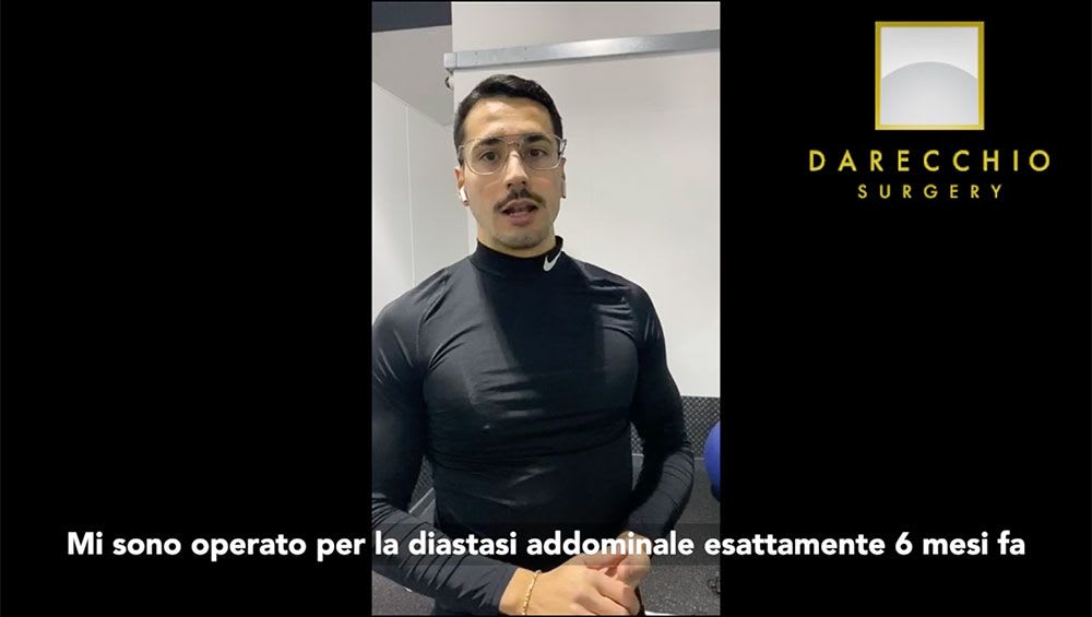 Intervento diastasi uomo e allenamento, recensione