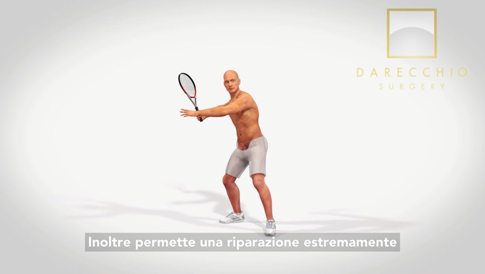 Inguinal hernia, sports man and professional football players