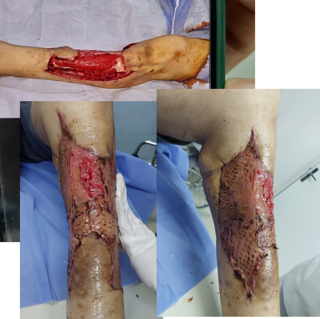 Imagen de la campaña 1