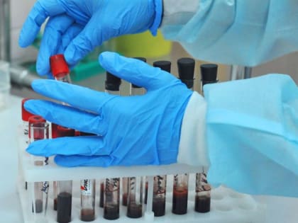 Коронавирус в Крыму и Севастополе - данные за сутки