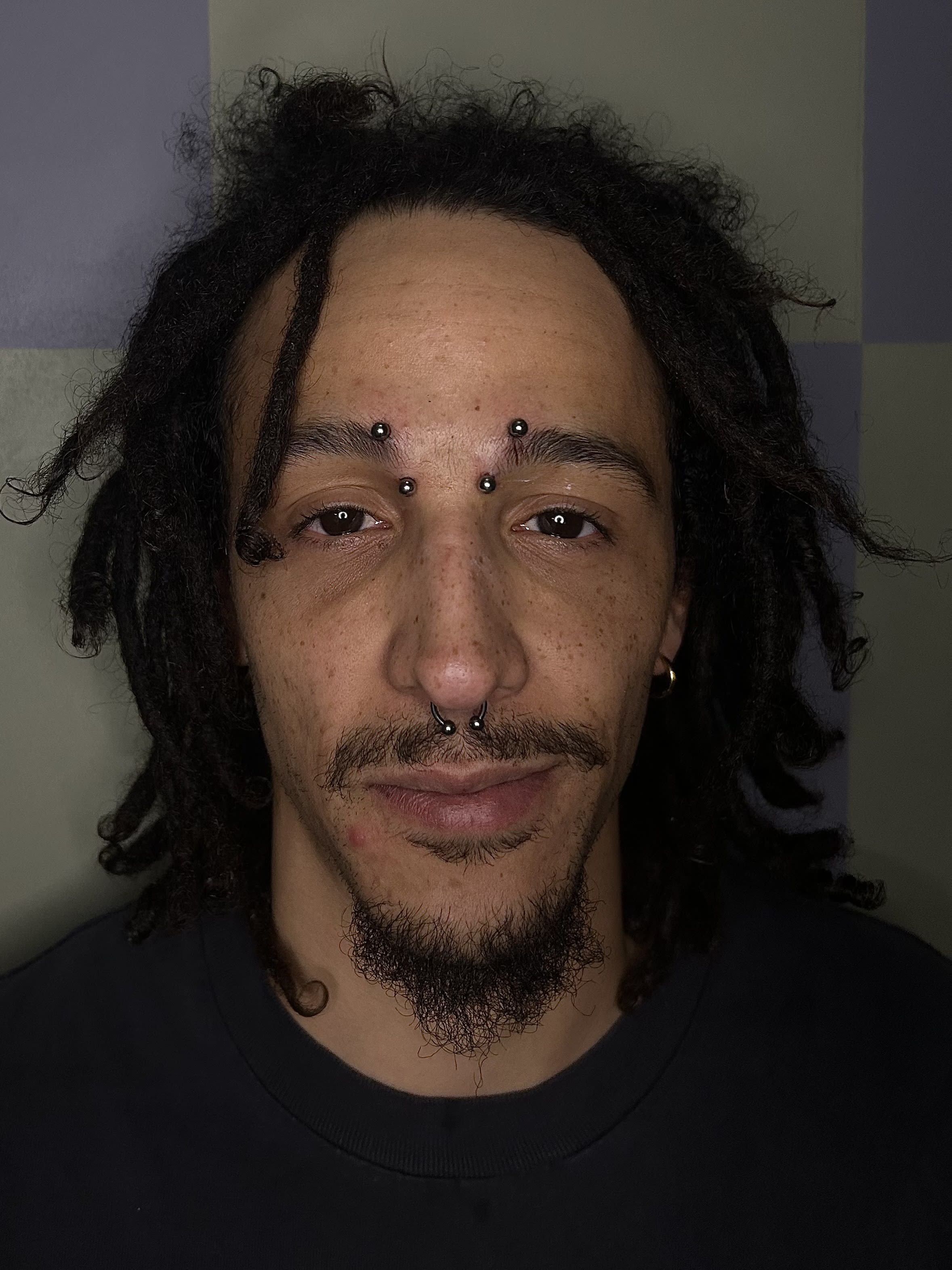 This client came in wanting a bridge piercing but ended up deciding on these inner brows. Inner brows have a good balance of a bridge like piercing while adding an element of uniqueness because of the non-traditional placement. Also pierced a septum on his face to add to the set up. This client had a great transfromation to walk in without a single piercing to leaving with a very distinctive setup. 