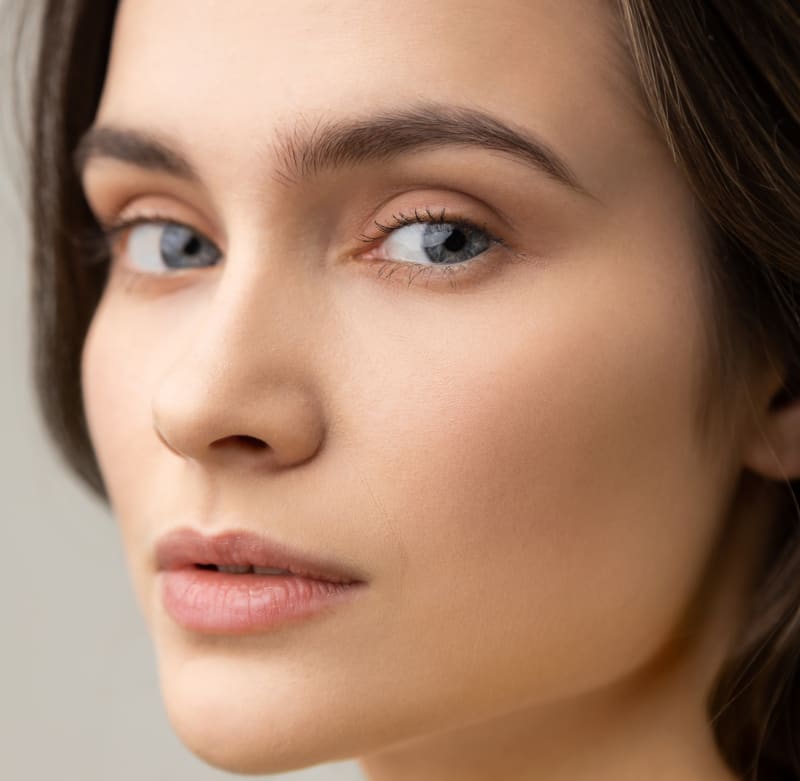 Restylane treatment results