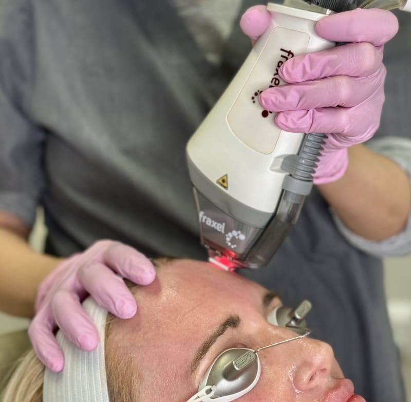 Fraxel Laser Science