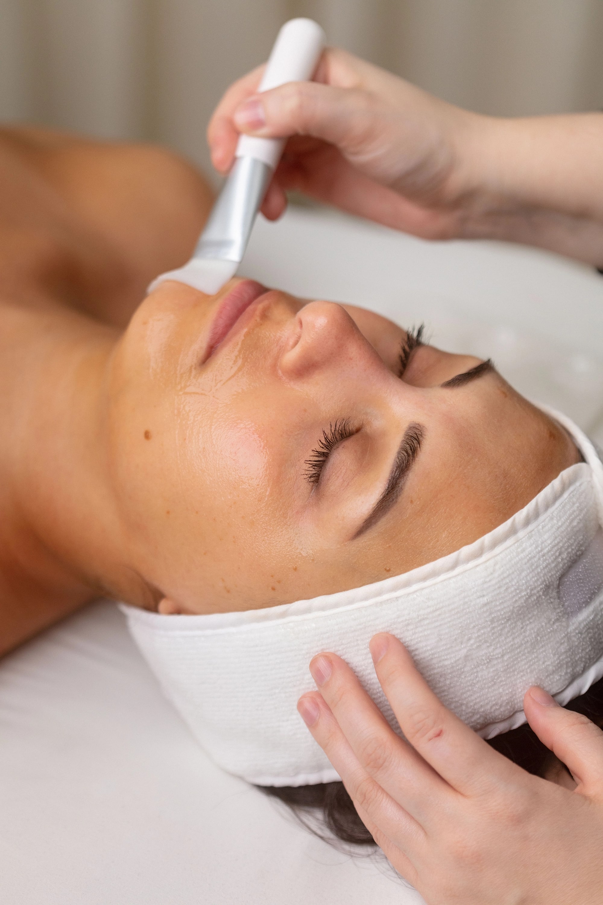 Woman with radiant skin after chemical peel treatment