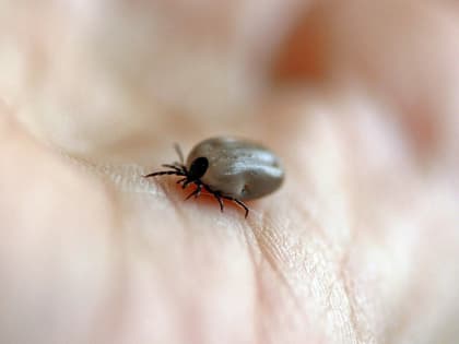 С начала сезона клещи покусали больше 5,3 тыс. югорчан