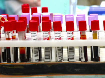 В Югре впервые нашли подходящего на 100% донора костного мозга