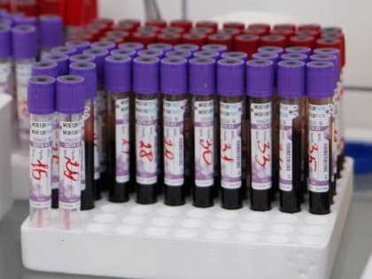 Медики Нефтеюганска опубликовали статистику «пикантных заболеваний» среди местных жителей