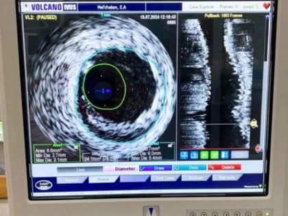 Хирурги Владивостока пробурили путь к сердцу пожилого мужчины