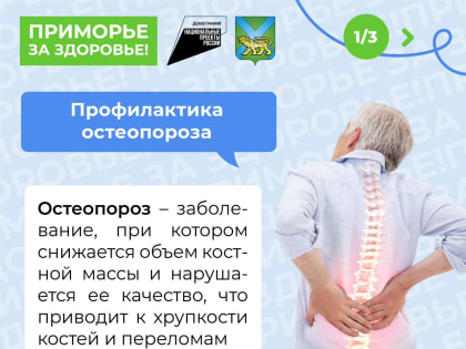 Остеопороз. Можно ли предотвратить ломкость костей?