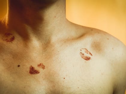 Как обнаружить рак во время секса? — советы для жителей Приморья