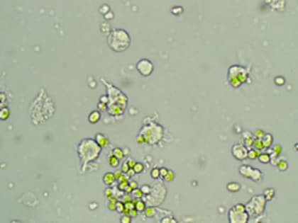 Зелёная угроза: двустворчатых моллюсков в Приморье может поразить болезнь от микроводорослей-паразитов (ФОТО)