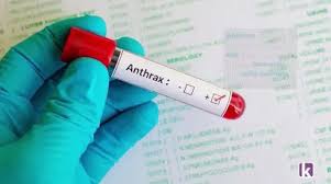 Anthrax