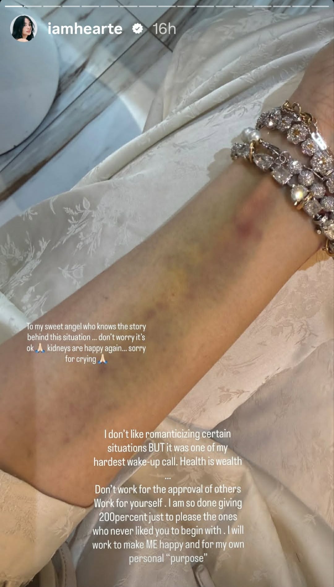 Heart Evangelista hospitalization update photo