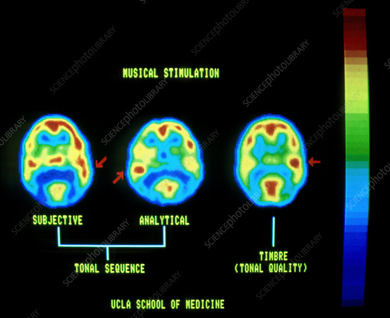 PET brain scans showing musical stimulation across subjective, analytical, and timbre processing