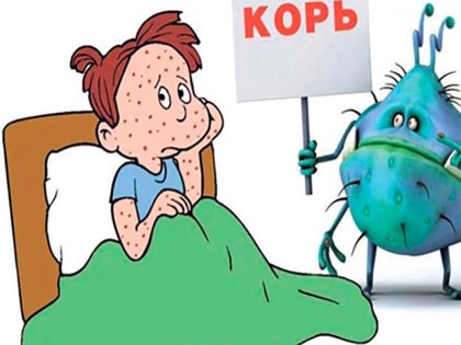 Профилактика кори. Памятка для населения