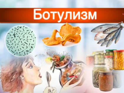 Десятки россиян из разных городов попали в больницы с ботулизмом — все они ели один и тот же салат