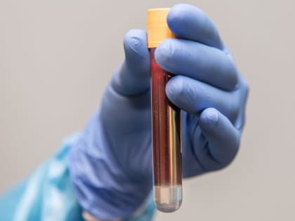 В Новозыбкове после выявления гепатита А у 10 человек начали дезинфекцию