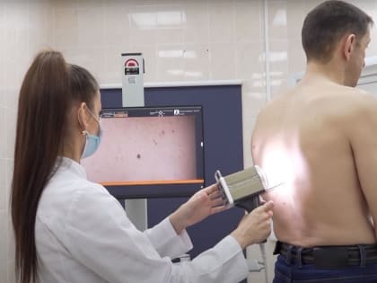 «Безобидных» меланом не бывает. Брянцам рассказали о новообразованиях на коже