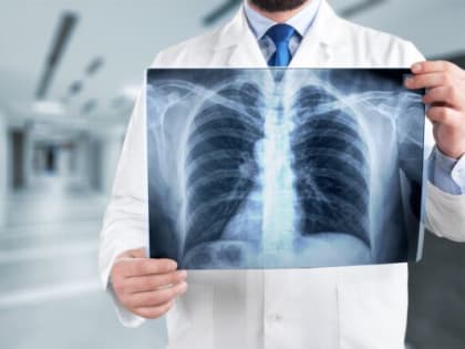 Амбулаторные пациенты Новозыбковской ЦРБ временно будут проходить рентгенографию грудной клетки в тубдиспансере