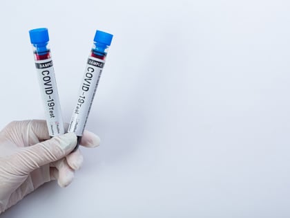 Статистика COVID-19 в Брянской области: за неделю плюс 61 больной, плюс одна смерть