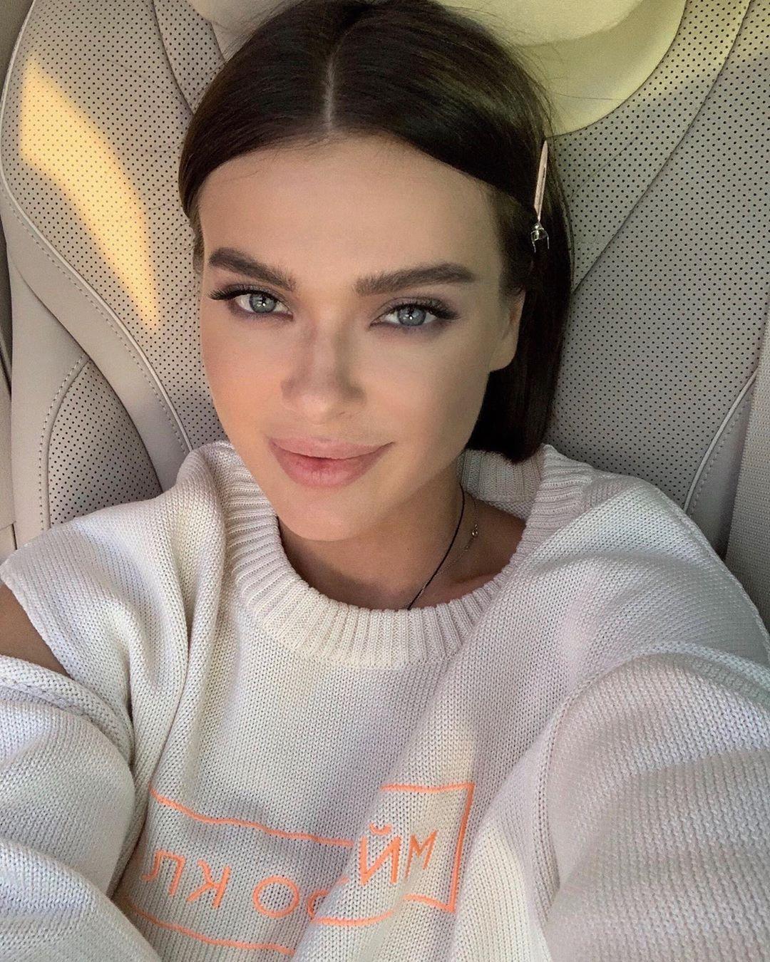 Щеки налились, как в 18 лет! Елене Темников удалили шрамы на лице с помощью жира с живота