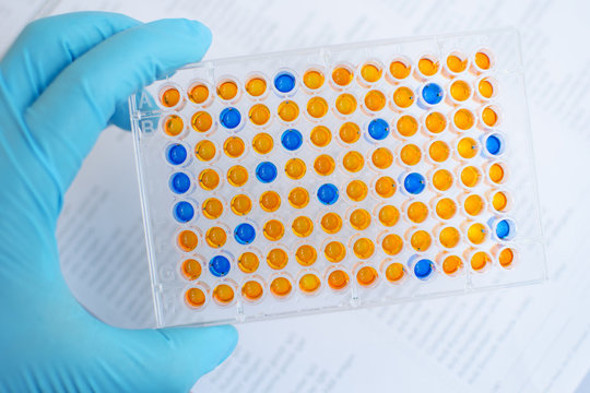 ELISA Testing