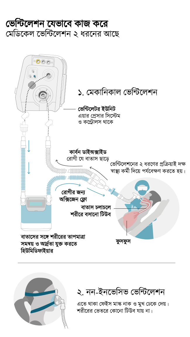 ভেন্টিলেটর যেভাবে কাজ করে