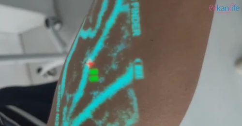 Kanlife Vein Finder
