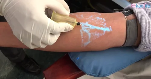 Kanlife Vein Finder
