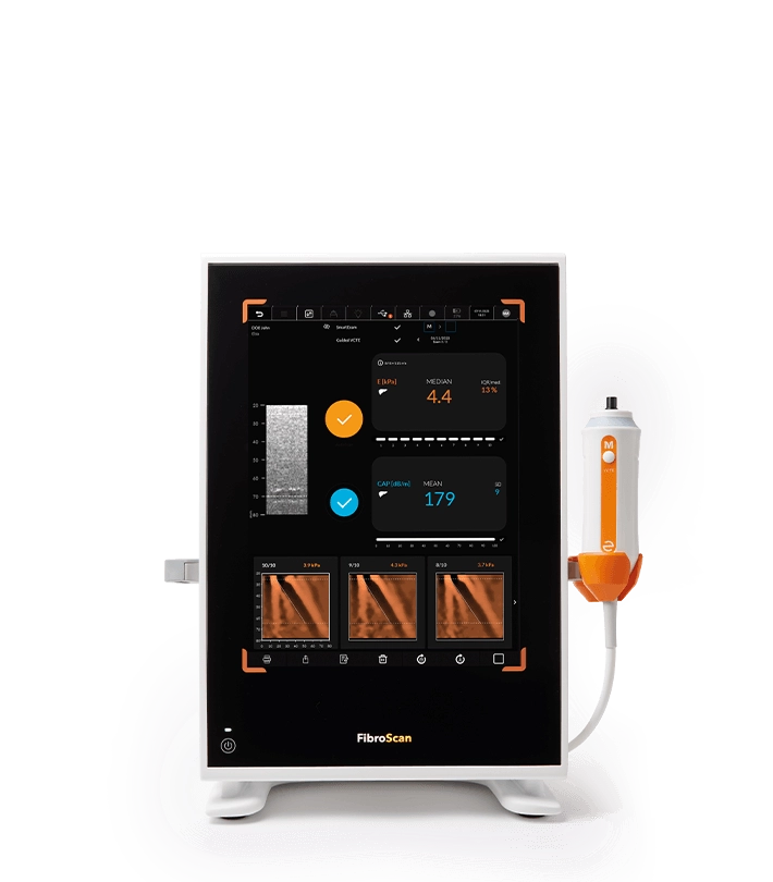 Fibroscan Compact 530 Echosens