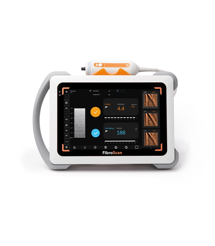 Fibroscan Mini 430 Echosens