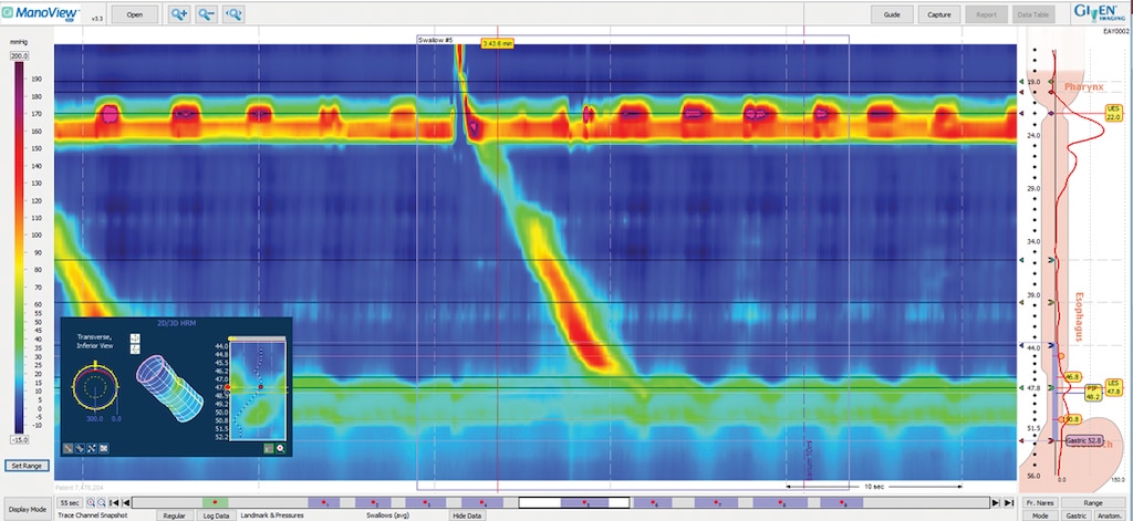 MANOSCAN ESO Z CATH X1